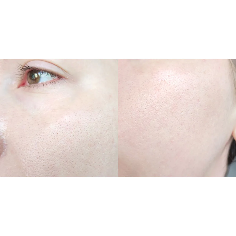 ژل شستشوی گود مورنینگ کوزارکس تنظیم PH پوست