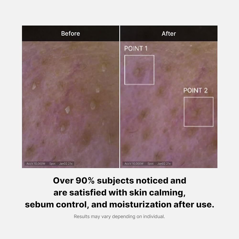 فوم پاک‌کننده سالیسیلیک اسید مدی کیوب Red Foam Cleanser