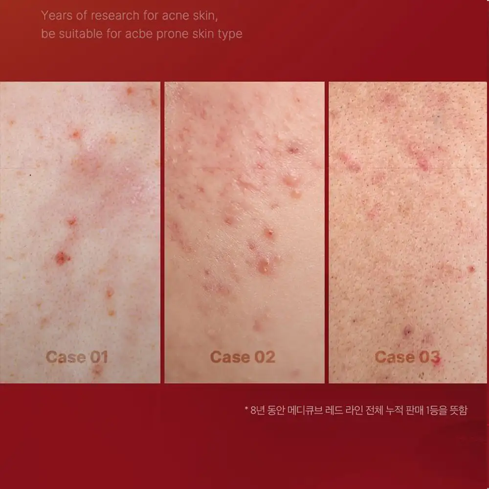 تونر ضد جوش و تسکین‌دهنده مدی کیوب Medicube Red Toner 2.0