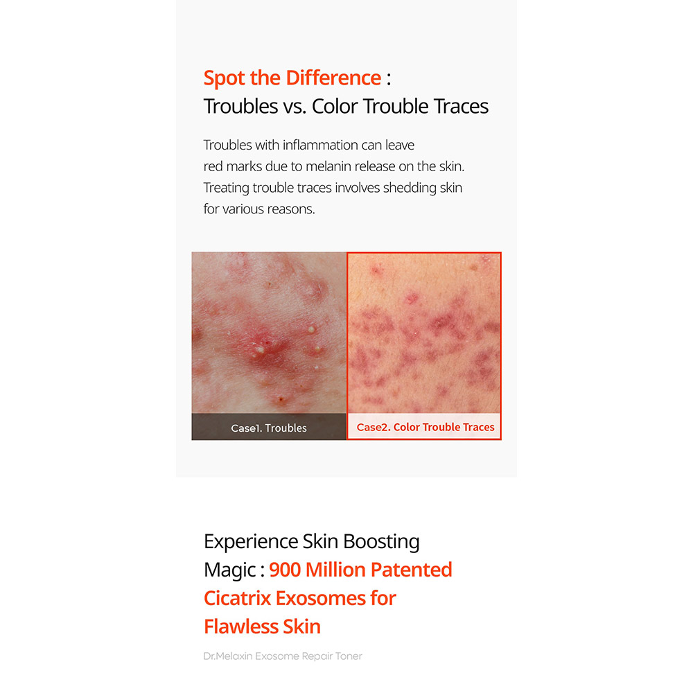 تونر ترمیم کننده اگزوزوم دکتر ملاکسین Dr.Melaxin Exosome Repair Toner