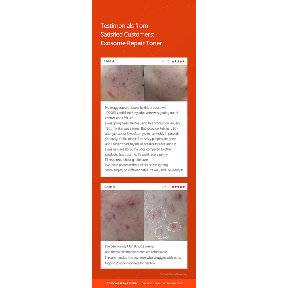 تونر ترمیم کننده اگزوزوم دکتر ملاکسین Dr.Melaxin Exosome Repair Toner