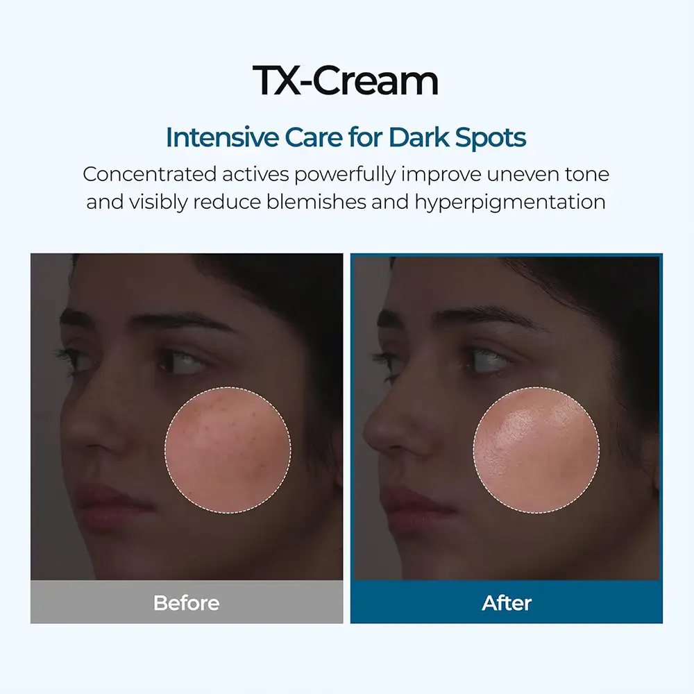 کرم ضد لک و روشن کننده ترانگزامیک اسید دکتر ملاکسین Dr.Melaxin TX Tranexamic Acid CREAM
