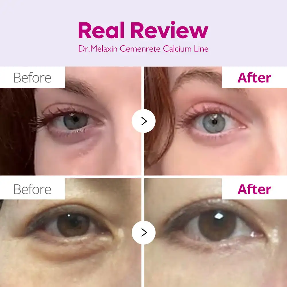 کرم دور چشم کلسیم دارک اسپات دکتر ملاکسین ضد چروک و روشن کننده قوی Dr. Melaxin Cemenrete Calcium Dark Spot Correcting Eye Cream