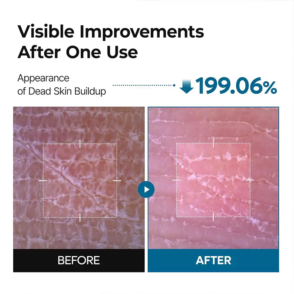اسپری پیل شات بدن ترانگزامیک اسید دکتر ملاکسین روشن کننده و لایه بردار ملایم