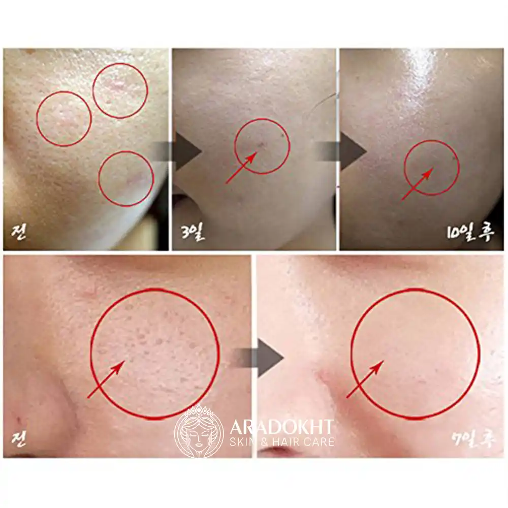 مزو کرم تسکین دهنده و ترمیم کننده سنتلا مدی پیل Medi-Peel Centella Mezzo Cream