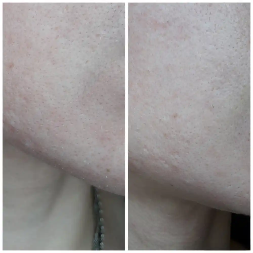 کرم مرطوب کننده و تغذیه کننده اتودرم بایودرما Bioderma Atoderm Cream Ultra | پوست خشک و حساس