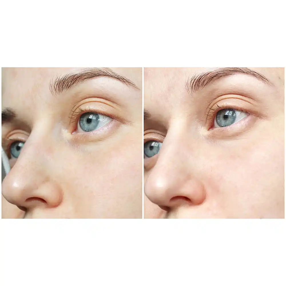 ژل شستشوی صورت سبیوم بایودرما Bioderma Sebium Gel Moussant | پوست چرب و مختلط مستعد آکنه