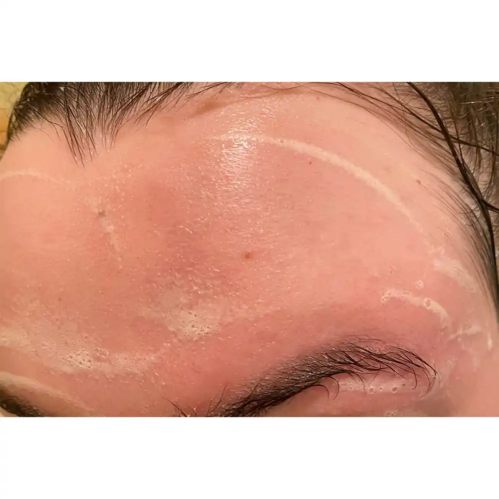 ژل شستشوی صورت سبیوم بایودرما Bioderma Sebium Gel Moussant | پوست چرب و مختلط مستعد آکنه