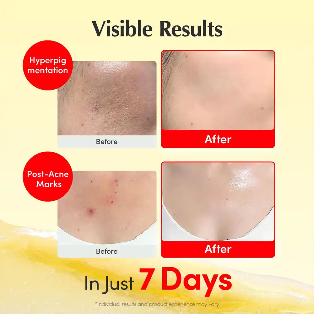 کرم کپسولی ویتامینه اکوال بری ضد لک قوی و روشن‌کننده EQQUALBERRY Vitamin Illuminating Cream
