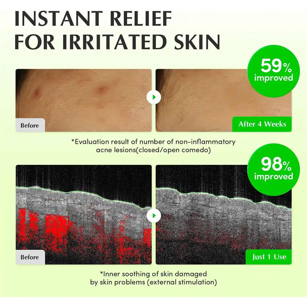تونر PDRN آلوئه‌ورا اکوال بری تسکین‌دهنده و ترمیم‌کننده پوست EQQUALBERRY Aloe PDRN Calming Toner