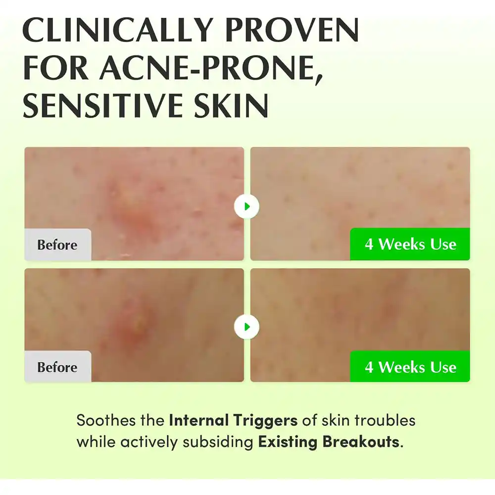 تونر PDRN آلوئه‌ورا اکوال بری تسکین‌دهنده و ترمیم‌کننده پوست EQQUALBERRY Aloe PDRN Calming Toner