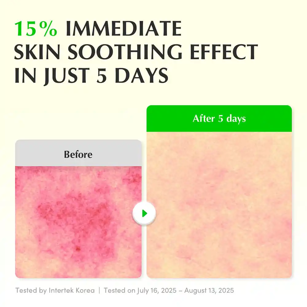 سرم PDRN و آلوئه‌ورا اکوال بری EQQUALBERRY Aloe PDRN Calming Serum