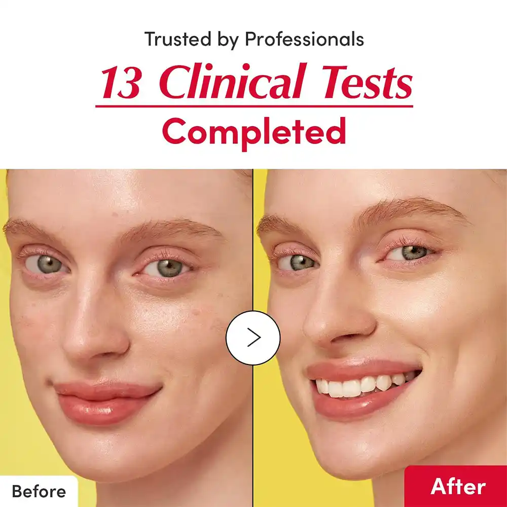 سرم ضد لک و روشن‌کننده ویتامین C اکوال بری | EQQUALBERRY Vitamin Illuminating Serum