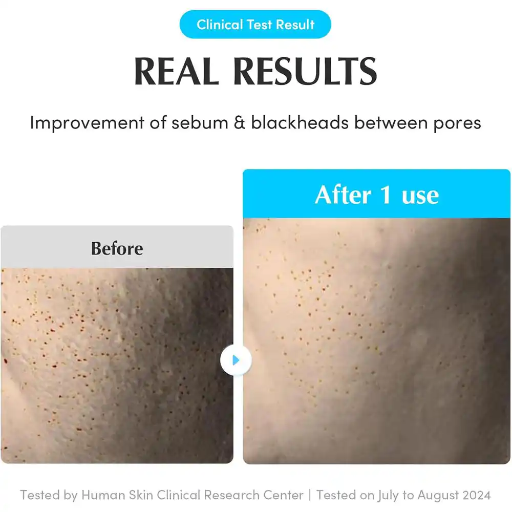 پد تونر آبرسان و تسکین‌دهنده اکوال بری EQQUALBERRY Swimming Pool Toner Pads