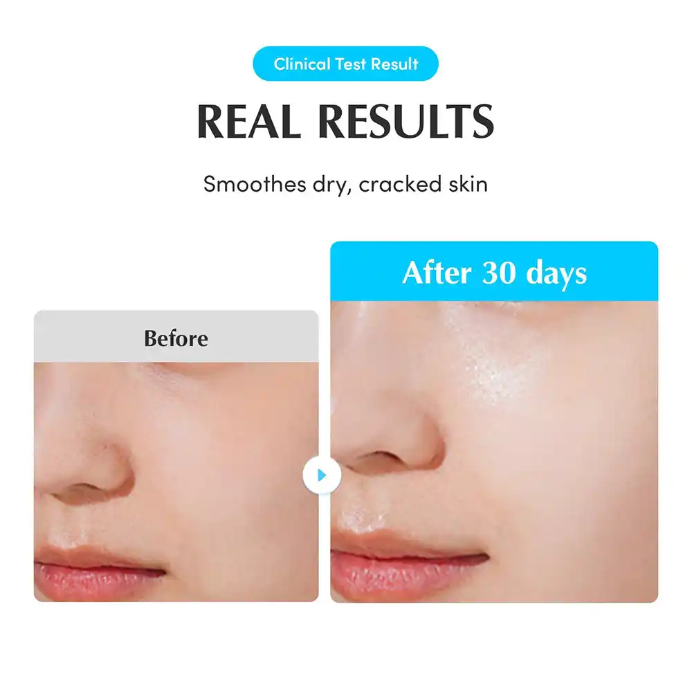 آمپول آبرسان و تسکین‌دهنده اکوال بری EQQUALBERRY Swimming Pool Ampoule