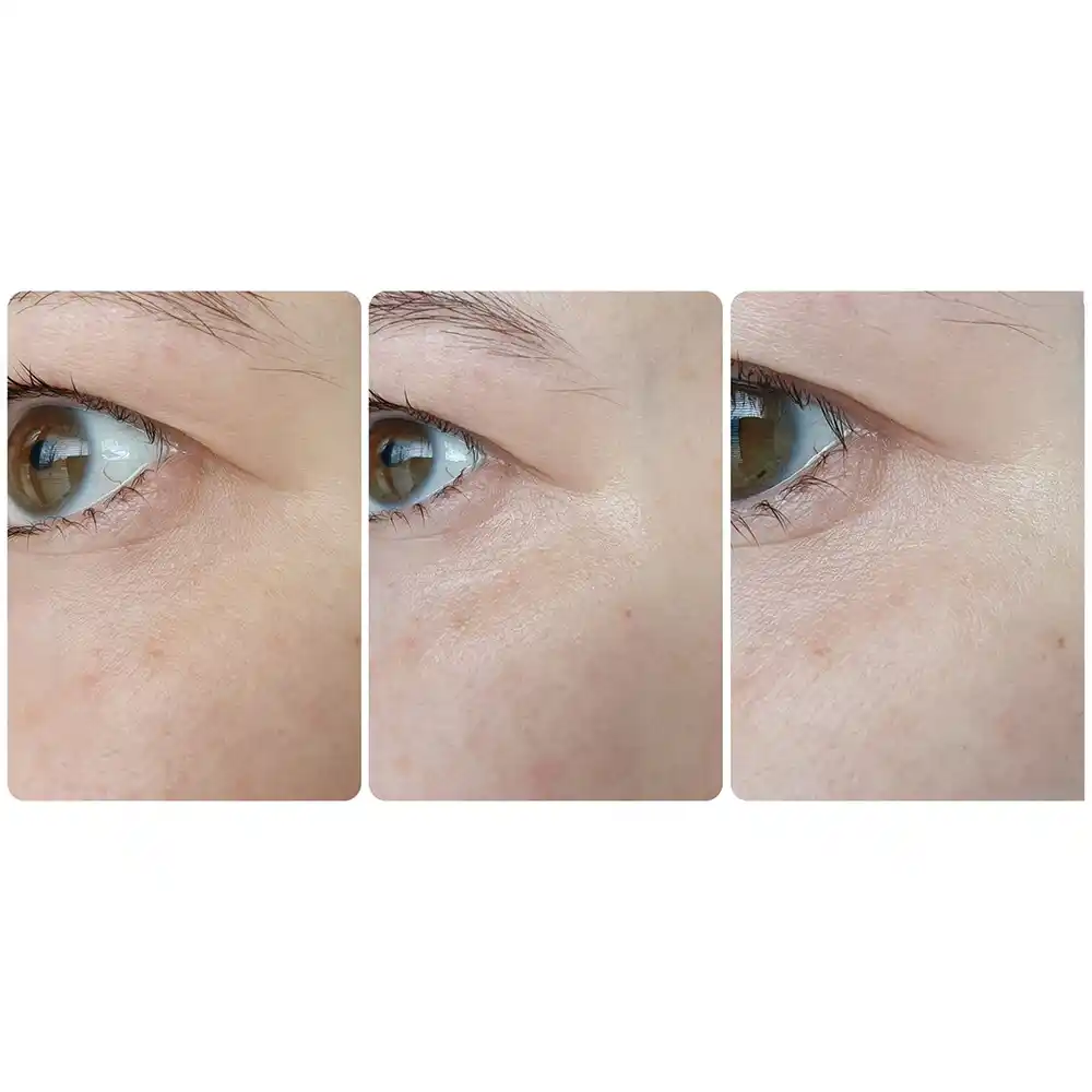 سرم ضد چروک و روشن‌کننده دور چشم رولی سرامید فارم استی Farmstay Ceramide Wrinkle Care Relaxing