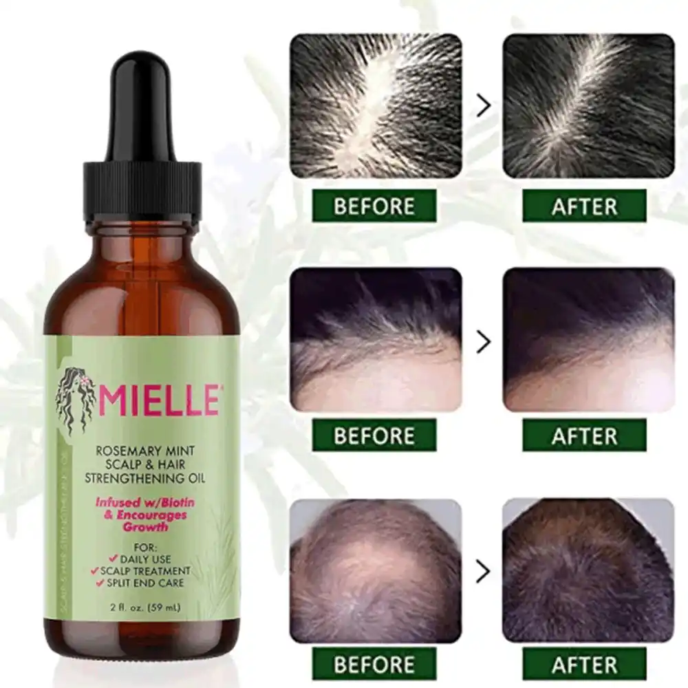 روغن ضد ریزش مو رزماری و نعناع میله ارگانیک Mielle Rosemary Mint Scalp Hair Oil