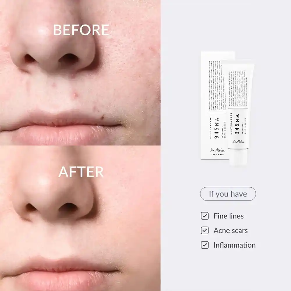 کرم مرطوب‌کننده و ضدلک دکترآلتیا Dr.Althea 345 Relief Cream | تسکین دهنده و روشن کننده