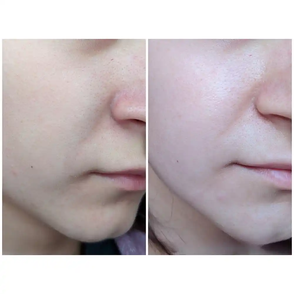 تونر ضد جوش 30 روزه سام بای می SOME BY MI AHA BHA PHA 30 Days Miracle Toner | کمک به کاهش ظاهر منافذ باز