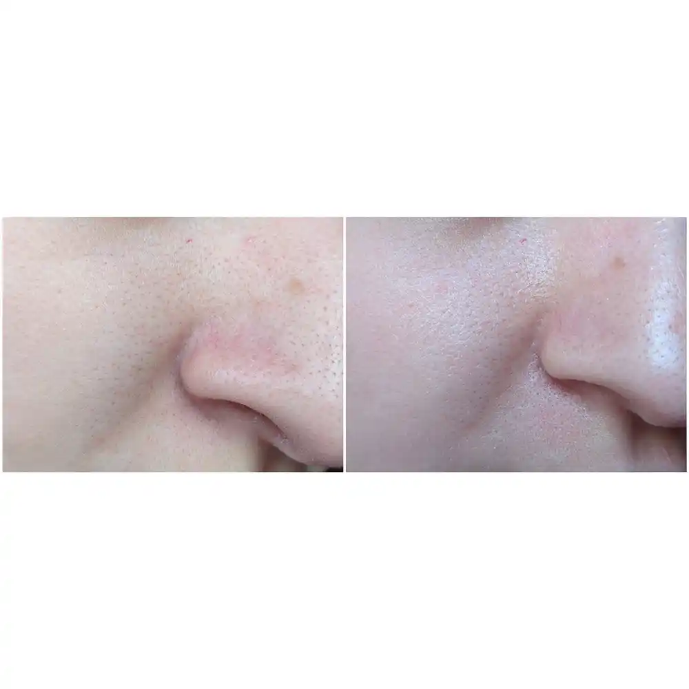 تونر ضد جوش 30 روزه سام بای می SOME BY MI AHA BHA PHA 30 Days Miracle Toner | کمک به کاهش ظاهر منافذ باز