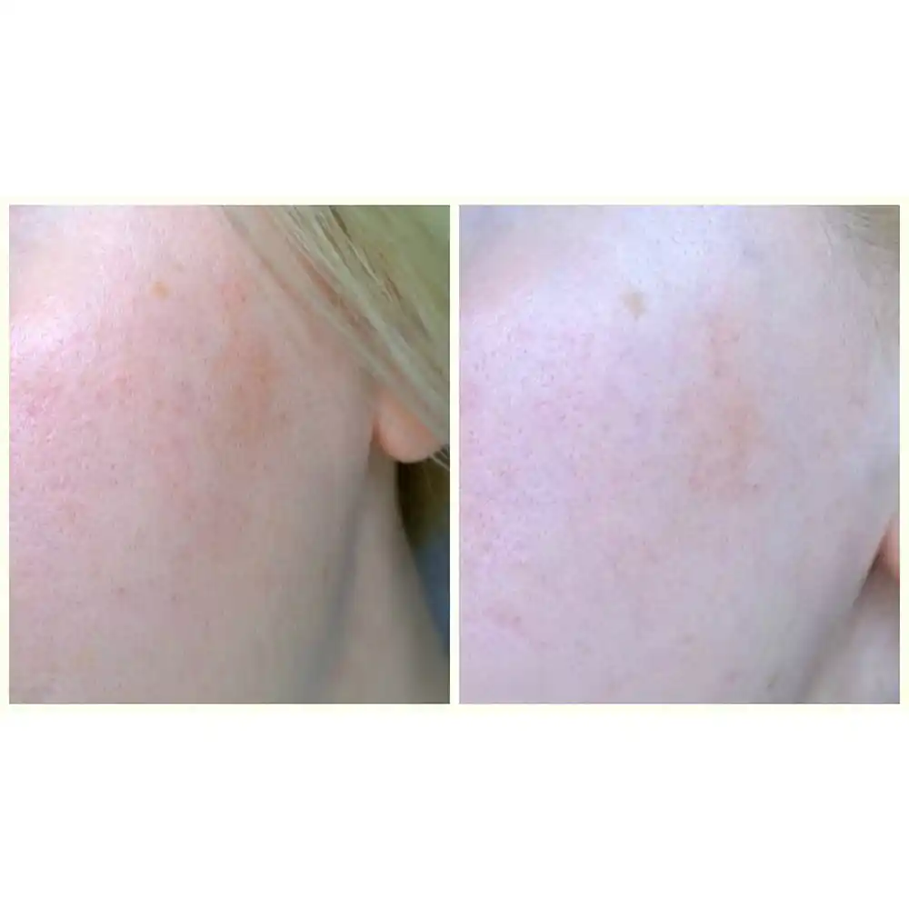 تونر ضد جوش 30 روزه سام بای می SOME BY MI AHA BHA PHA 30 Days Miracle Toner | کمک به کاهش ظاهر منافذ باز