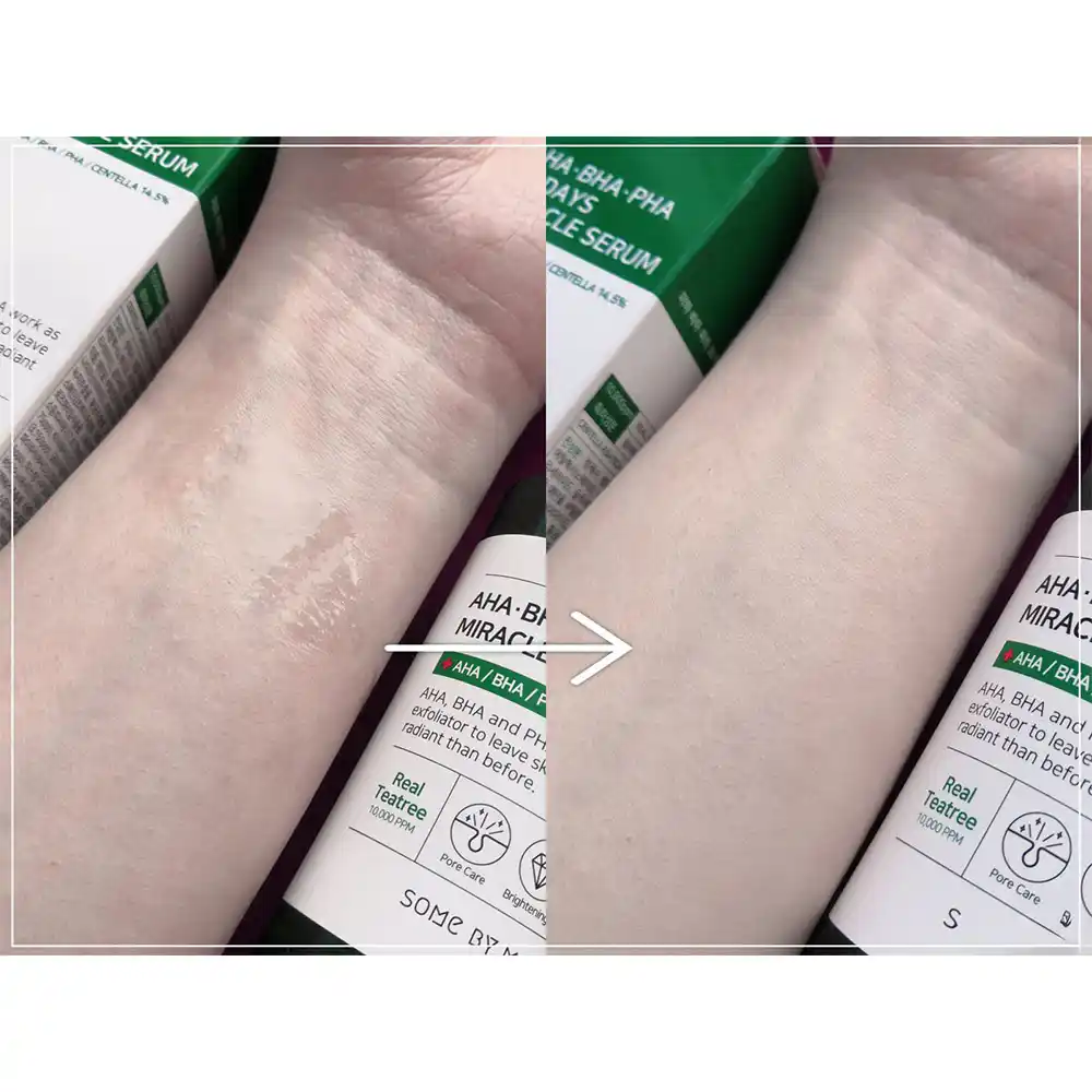سرم ضد جوش سام بای می SOME BY MI AHA BHA PHA 30 Days Miracle Serum 50ml | کنترل چربی، کاهش جوش و منافذ باز