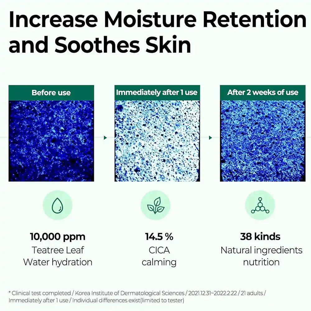 سرم ضد جوش سام بای می SOME BY MI AHA BHA PHA 30 Days Miracle Serum 50ml | کنترل چربی، کاهش جوش و منافذ باز