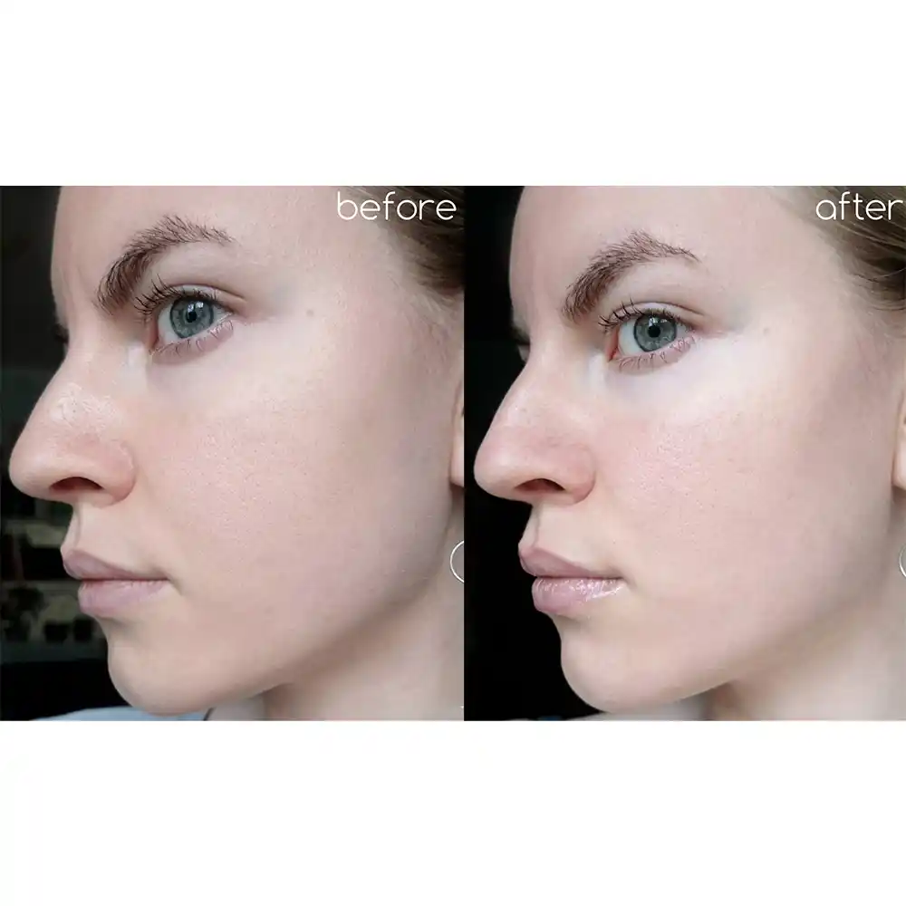 سرم ضد لک یوجا نیاسین سام بای می SOME BY MI Yuja Niacin Anti Blemish Serum 50ml | روشن‌کننده، ضد لک و جای جوش