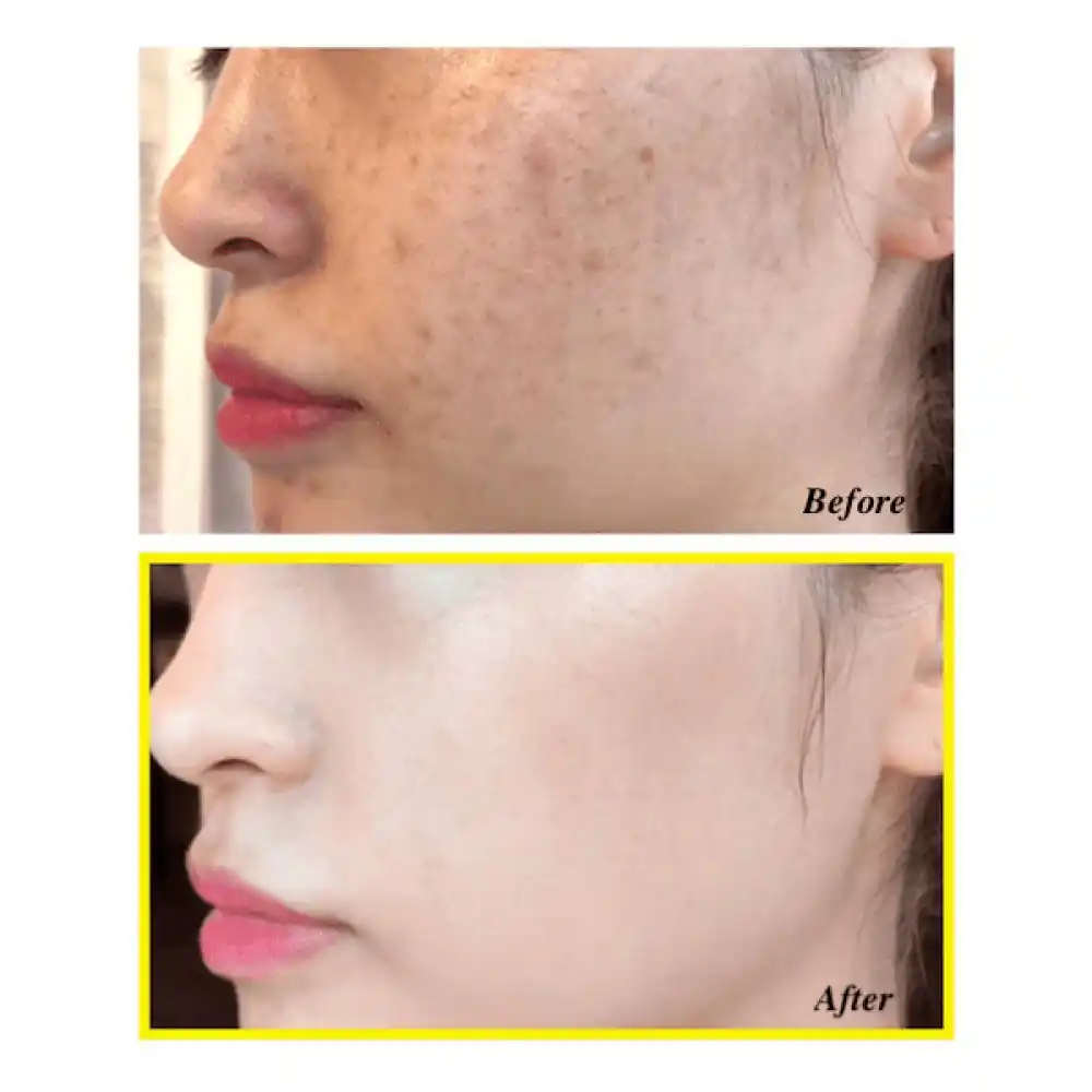 سرم ضد لک یوجا نیاسین سام بای می SOME BY MI Yuja Niacin Anti Blemish Serum 50ml | روشن‌کننده، ضد لک و جای جوش