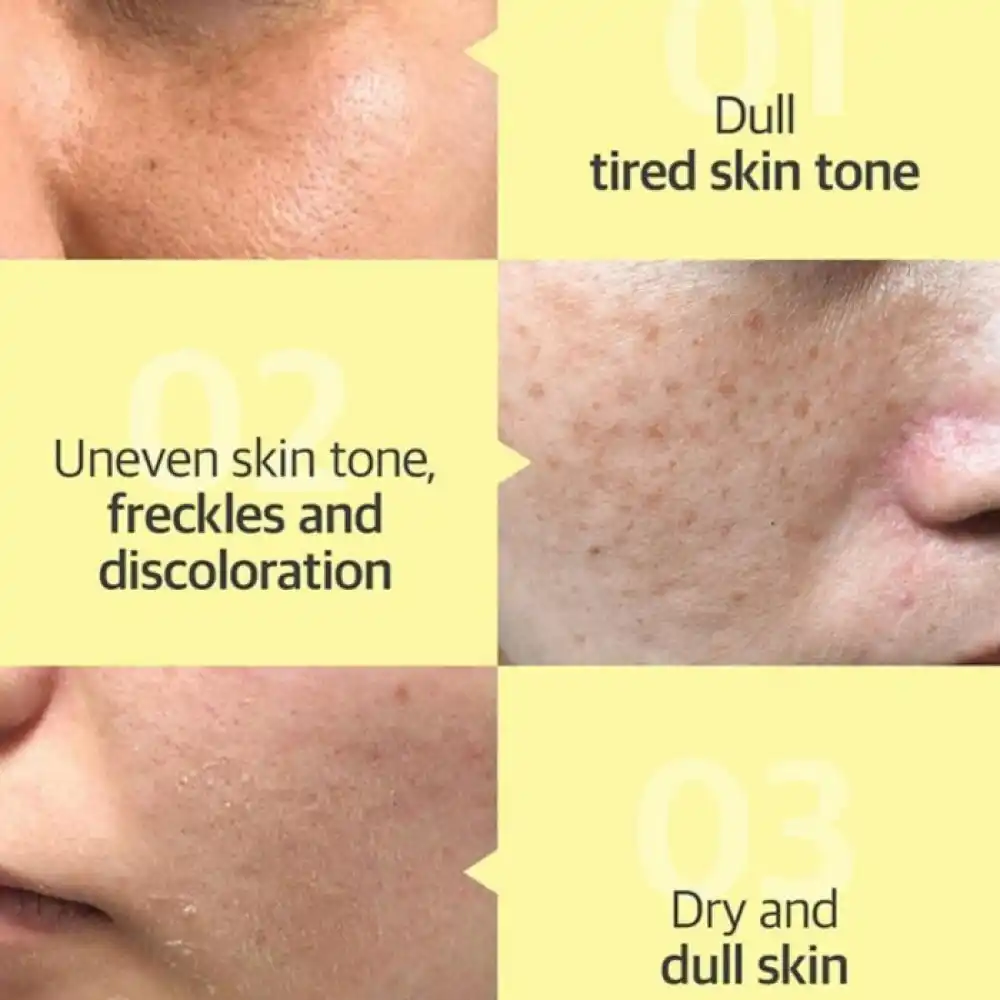 سرم ضد لک یوجا نیاسین سام بای می SOME BY MI Yuja Niacin Anti Blemish Serum 50ml | روشن‌کننده، ضد لک و جای جوش