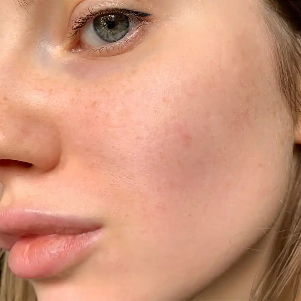 سرم ضد لک یوجا نیاسین سام بای می SOME BY MI Yuja Niacin Anti Blemish Serum 50ml | روشن‌کننده، ضد لک و جای جوش