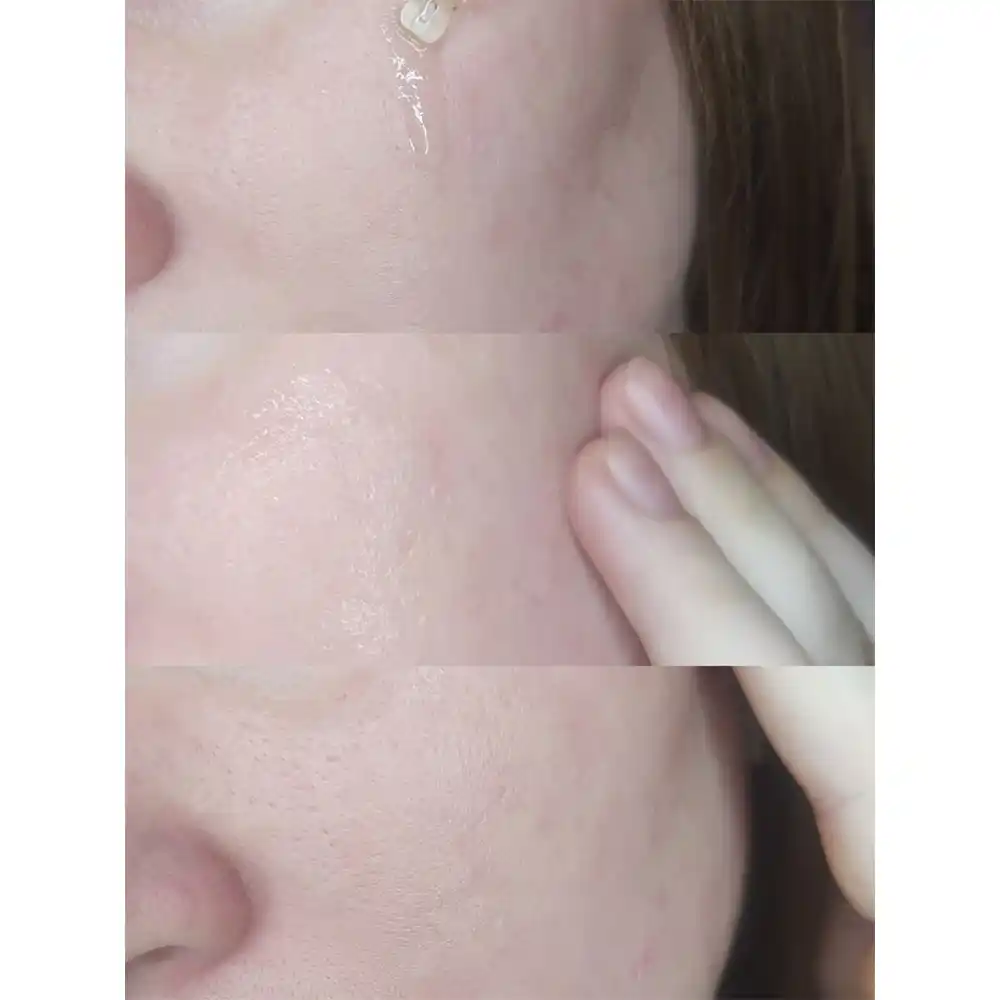 سرم ضد لک یوجا نیاسین سام بای می SOME BY MI Yuja Niacin Anti Blemish Serum 50ml | روشن‌کننده، ضد لک و جای جوش