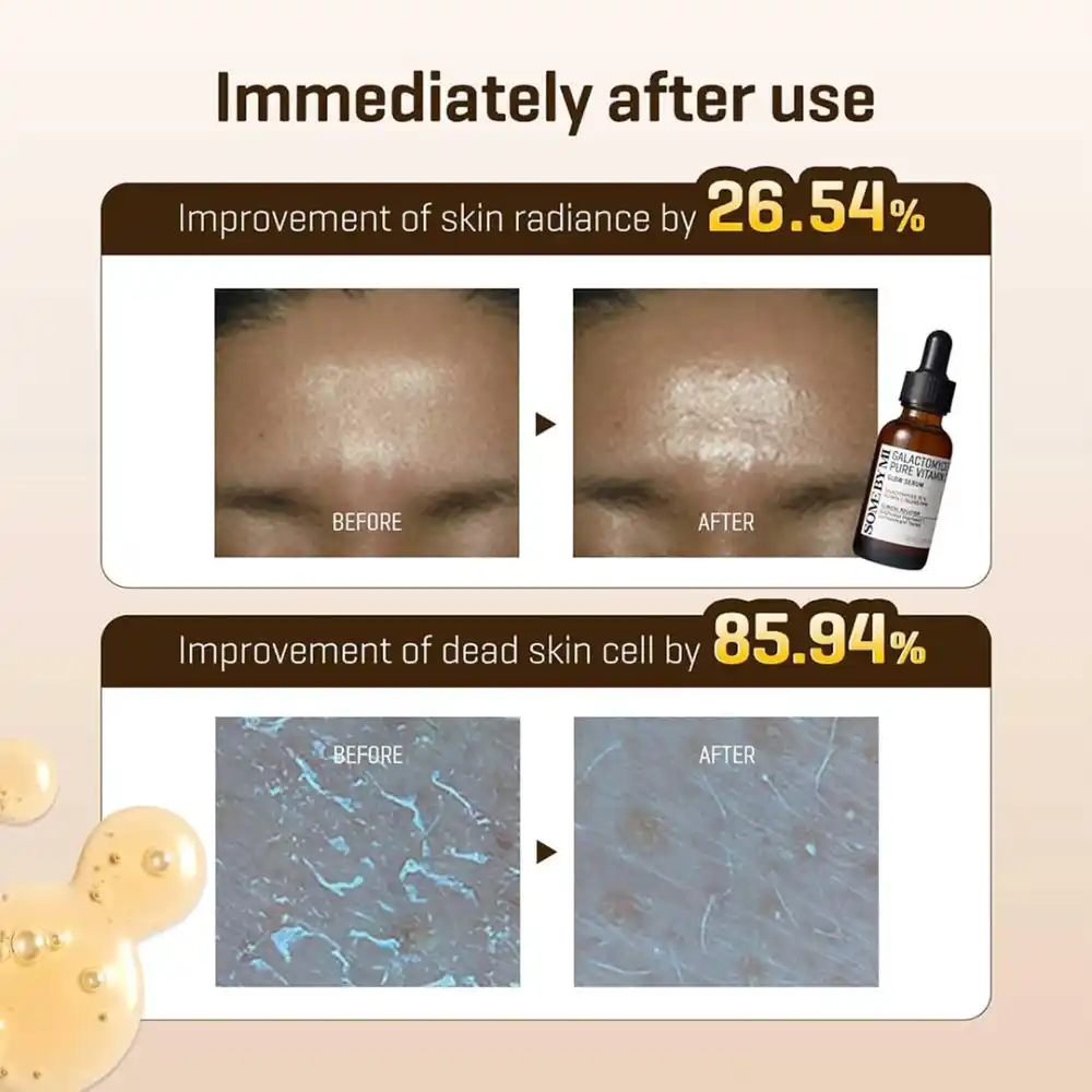 سرم ویتامین سی سام بای می SOME BY MI Galactomyces Pure Vitamin C Glow Serum 30ml | روشن‌کننده، ضد لک و کاهش جای جوش