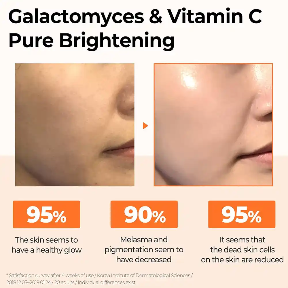 سرم ویتامین سی سام بای می SOME BY MI Galactomyces Pure Vitamin C Glow Serum 30ml | روشن‌کننده، ضد لک و کاهش جای جوش