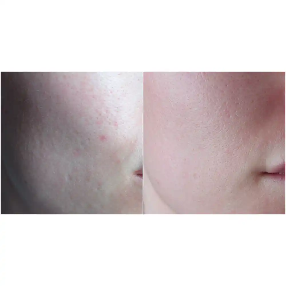 سرم ویتامین سی سام بای می SOME BY MI Galactomyces Pure Vitamin C Glow Serum 30ml | روشن‌کننده، ضد لک و کاهش جای جوش