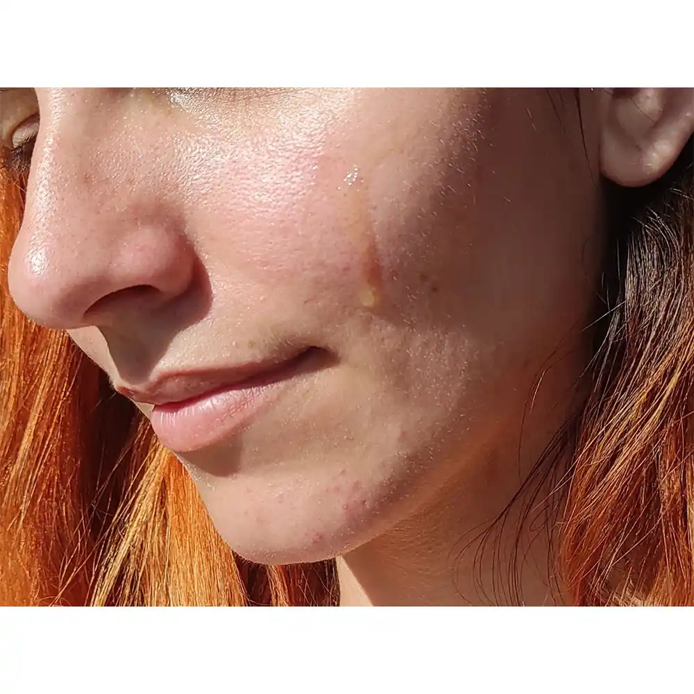 سرم ویتامین سی سام بای می SOME BY MI Galactomyces Pure Vitamin C Glow Serum 30ml | روشن‌کننده، ضد لک و کاهش جای جوش
