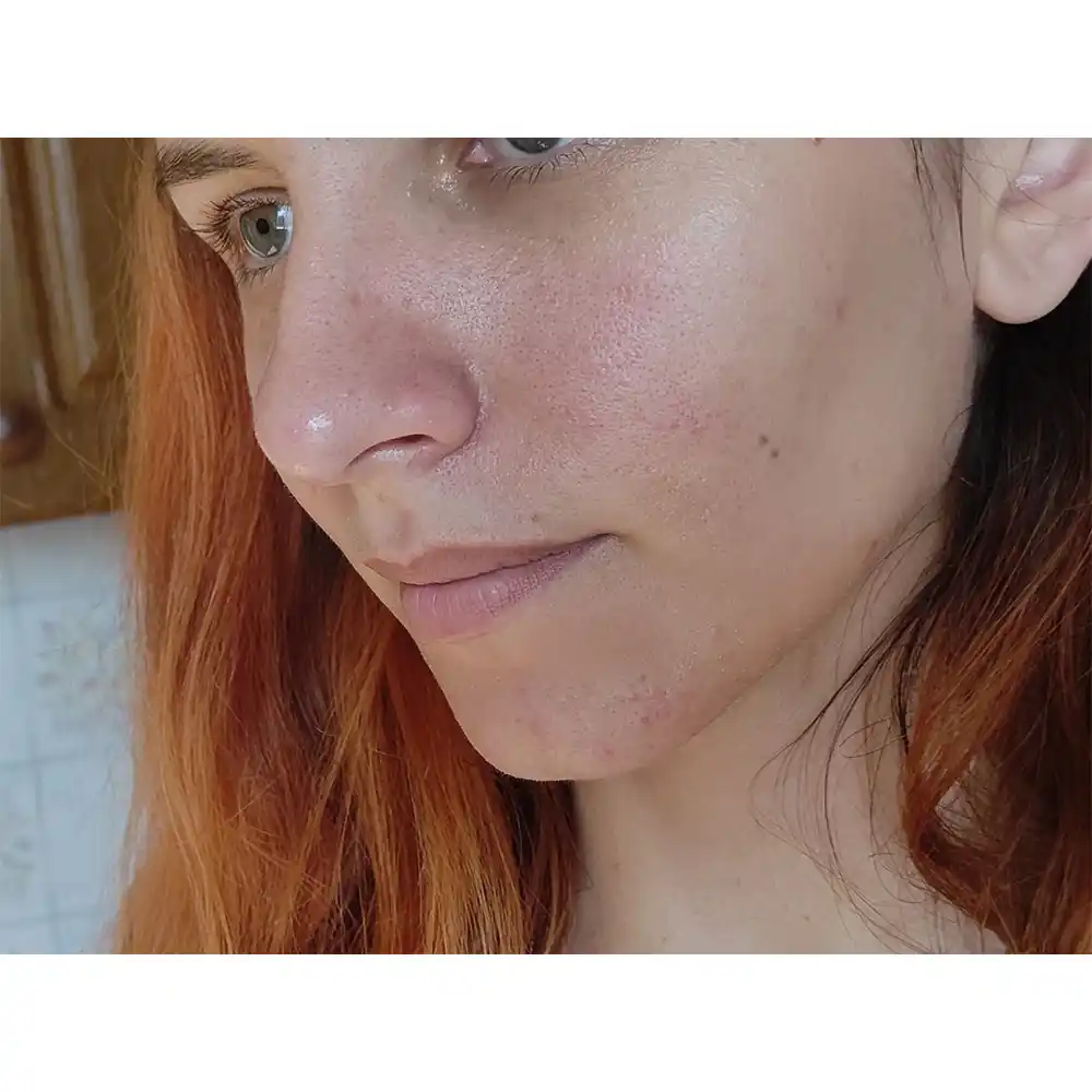 سرم ویتامین سی سام بای می SOME BY MI Galactomyces Pure Vitamin C Glow Serum 30ml | روشن‌کننده، ضد لک و کاهش جای جوش
