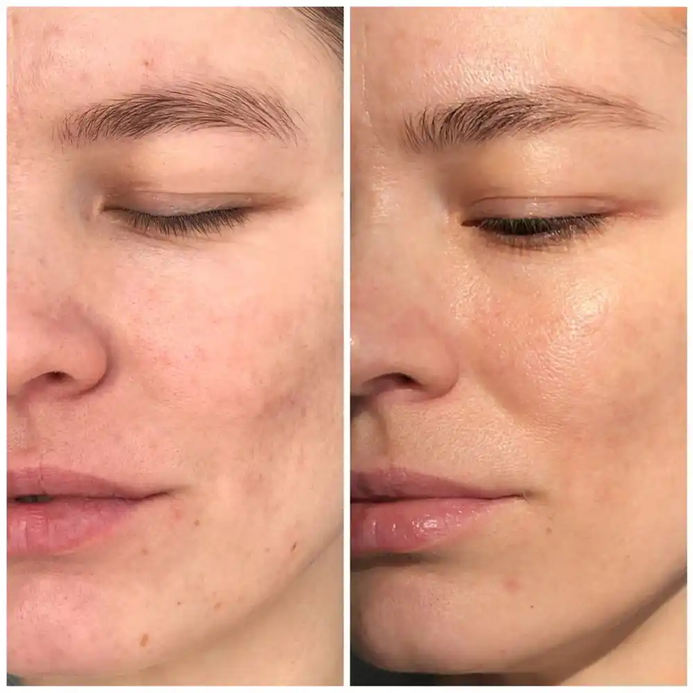 سرم ویتامین سی سام بای می SOME BY MI Galactomyces Pure Vitamin C Glow Serum 30ml | روشن‌کننده، ضد لک و کاهش جای جوش