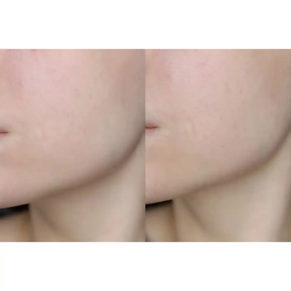 سرم ویتامین سی سام بای می SOME BY MI Galactomyces Pure Vitamin C Glow Serum 30ml | روشن‌کننده، ضد لک و کاهش جای جوش