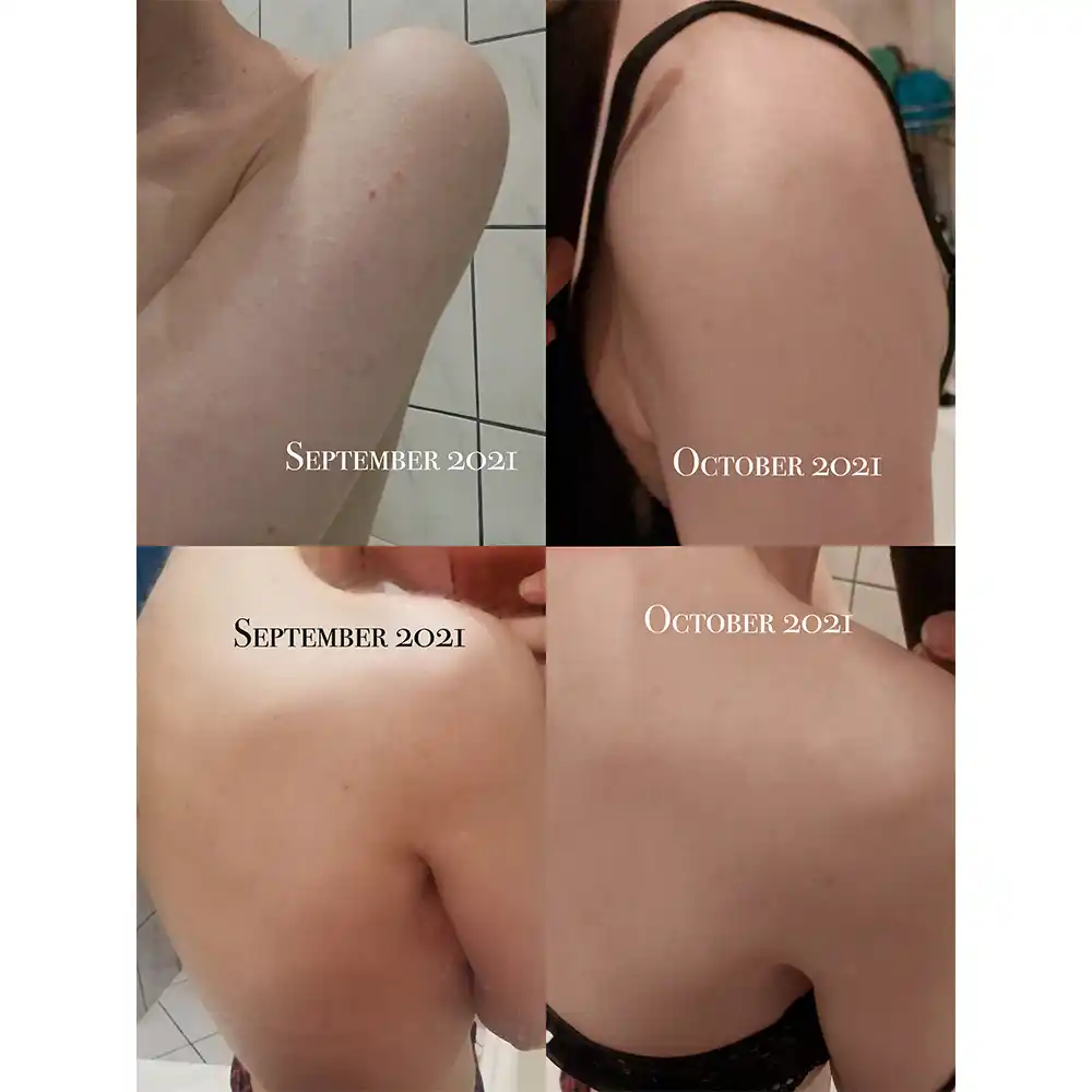 شوینده بدن ضد جوش 30 روزه میراکل سام بای می SOME BY MI Miracle Acne Clear Body Cleanser 400g | ضد جوش بدن و کاهش لک