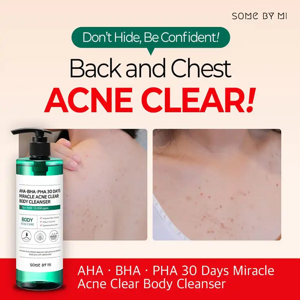 شوینده بدن ضد جوش 30 روزه میراکل سام بای می SOME BY MI Miracle Acne Clear Body Cleanser 400g | ضد جوش بدن و کاهش لک