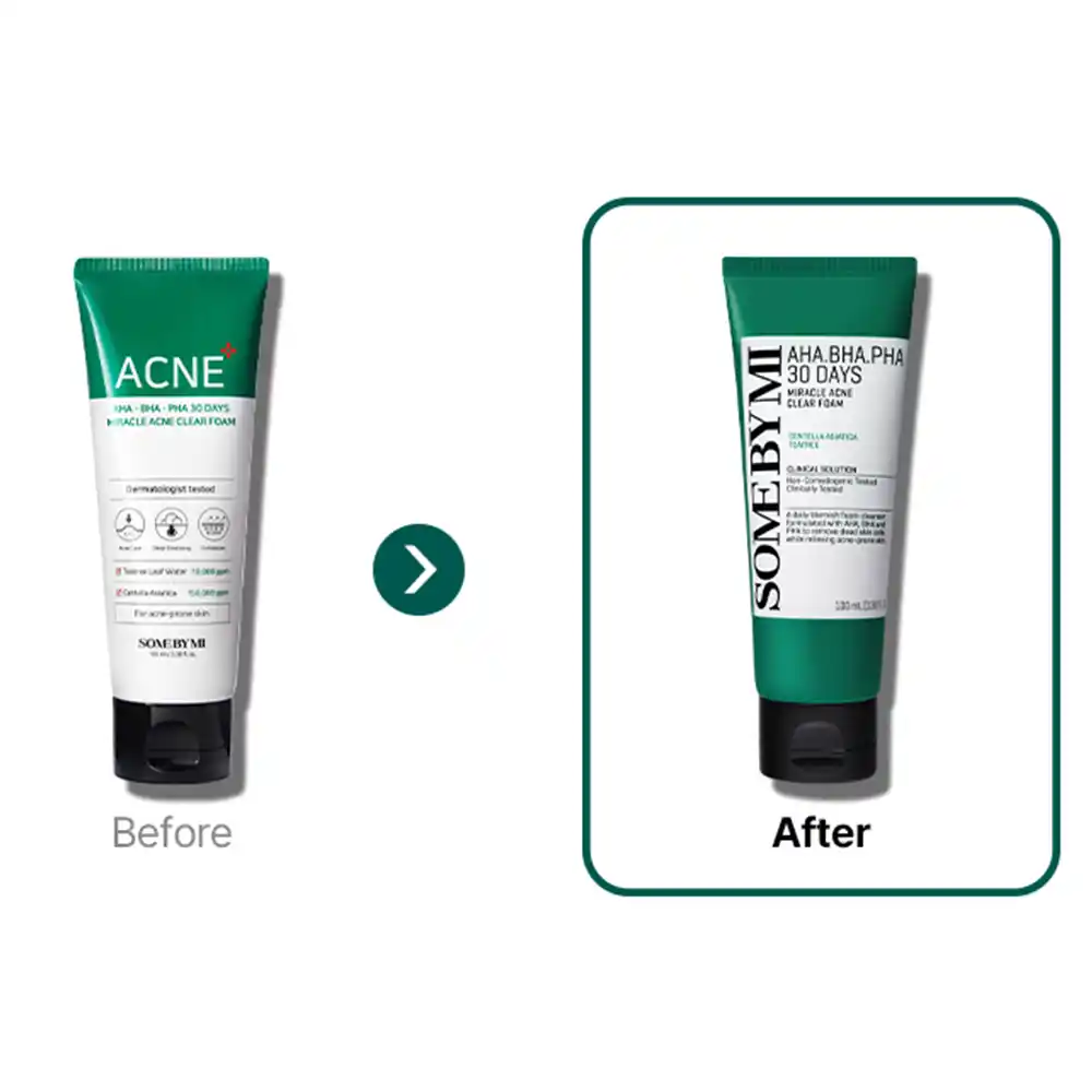 فوم ضد جوش لایه بردار میراکل سام بای می SOME BY MI AHA BHA PHA 30 Days Miracle Acne Clear Foam 100ml | پاکسازی منافذ و کنترل چربی