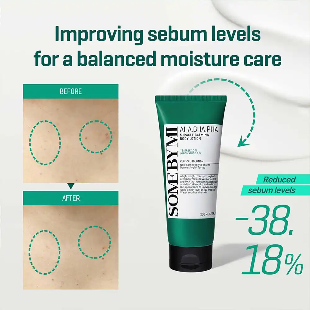 لوسیون بدن میراکل ضد جوش سام بای می SOME BY MI Miracle Calming Body Lotion 200ml | ضد جوش، آبرسان و تسکین‌دهنده