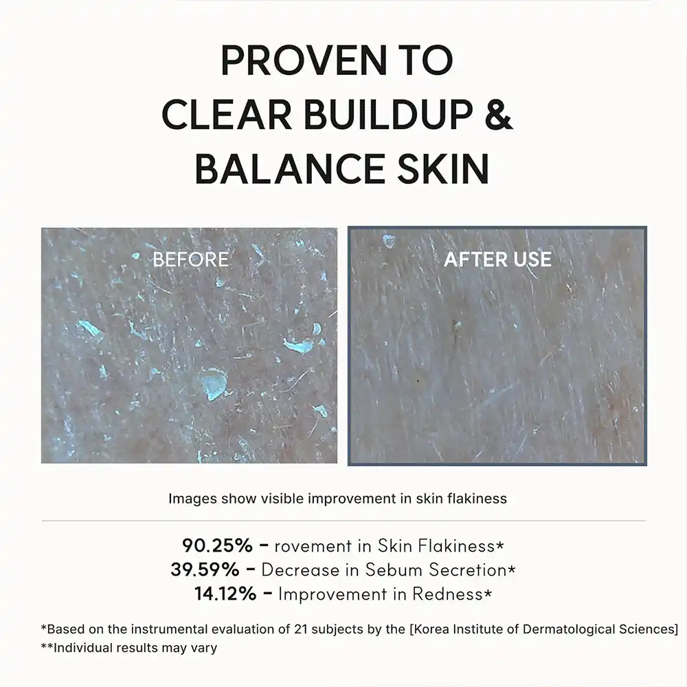 سرم گلیکولیک اسید آرنسیا Arencia Glycolic Acid Booster Serum 30ml | لایه‌بردار، کنترل چربی و کاهش ظاهر منافذ