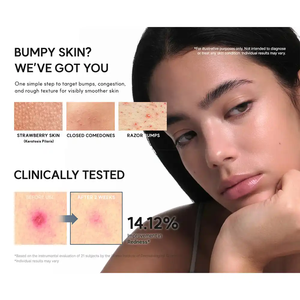 سرم گلیکولیک اسید آرنسیا Arencia Glycolic Acid Booster Serum 30ml | لایه‌بردار، کنترل چربی و کاهش ظاهر منافذ