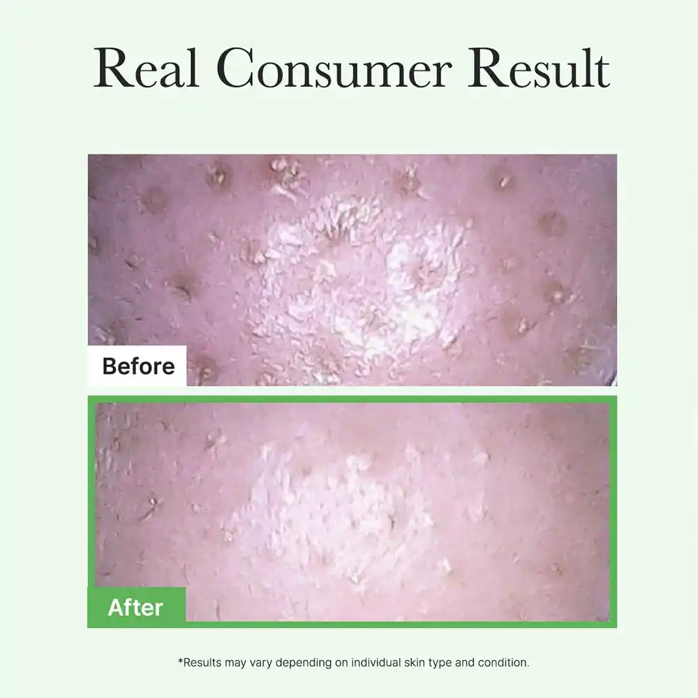 شوینده روغنی موچی آرنسیا Arencia Pore Melt Mochi Cleansing Oil | پاک‌کننده آرایش، منافذ و چربی پوست