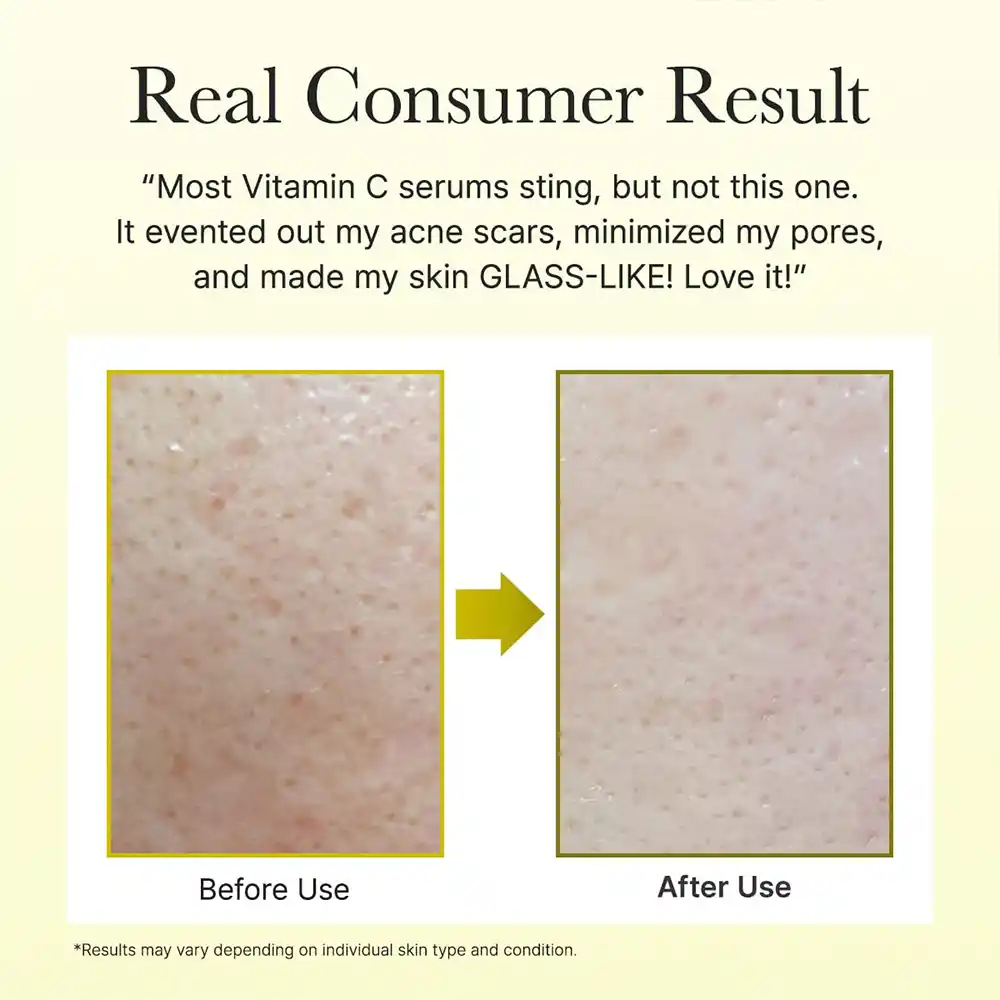سرم دور چشم و صورت ویتامین C بوستر شات آرنسیا Arencia Vitamin C Booster Shot Serum | روشن‌کننده، ضد لک و مرطوب‌کننده پوست