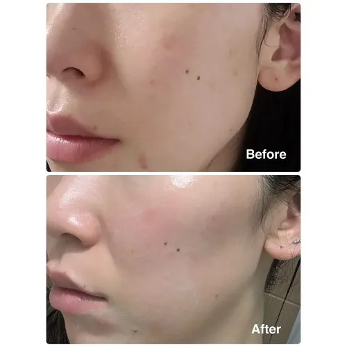 کرم مرطوب کننده گلوتاتیون ابیب Abib Glutathiosome Creme Vita Tube |  ضد لک روشن کننده و تقویت سد دفاعی پوست