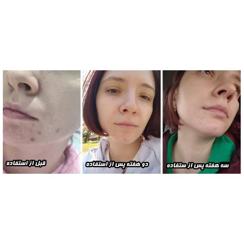 سرم روشن کننده بیوتی آف جوسان با ویتامین C پایدار و سنتلا  Beauty of Joseon Light On Serum