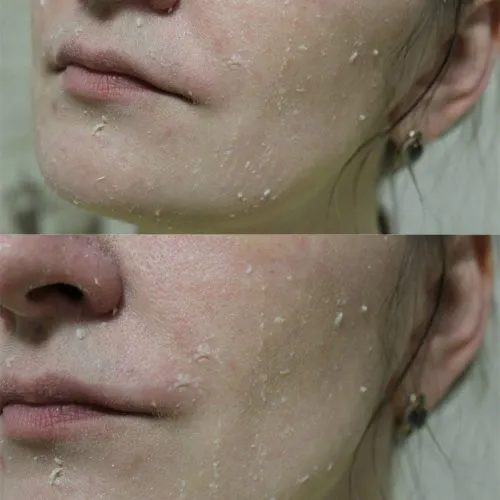ژل پیلینگ شکوفه زرد آلو بیوتی آف جوسان Beauty of Joseon Apricot Blossom Peeling Gel | لایه بردار و  آبرسان